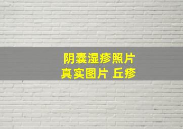 阴囊湿疹照片真实图片 丘疹